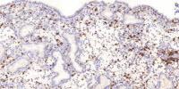 Womb Natural Killer Cell Discovery Could Lead to Screening for Miscarriage Risk