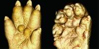 Enhanced Evolution: Scientists Find Genetic Swap Changes Physical Expression