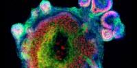 Hairy Skin Grown from Mouse Stem Cells