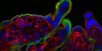 How Zika Infection Drives Fetal Demise