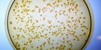 Protein Designed Entirely from Scratch Functions in Cells as a Genuine Enzyme