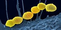 Want to Beat Antibiotic-Resistant Superbugs? Rethink That Strep Throat Remedy