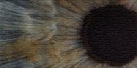 Artificial Intelligence Quickly and Accurately Diagnoses Eye Diseases and Pneumonia