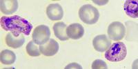 New Evidence Shows Potential of Two Drugs to Block Malaria Transmission