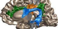 Democratizing Science: Researchers Make Neuroscience Experiments Easier to Share, Reproduce