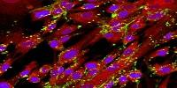 For Nanomedicine, Cell Sex Matters