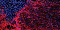 Gene Therapy May Help Brain Heal from Stroke, Other Injuries