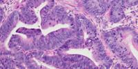 In Laboratory, Scientist Turns off Chemo Pain