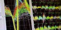 Monkeys' Brains Synchronize as They Collaborate to Perform a Motor Task