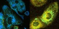 Researchers Develop Label-Free, Non-Destructive Tools to Detect Metabolic Changes Linked to Disease