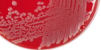 Foodborne Illness Caused by Common Agricultural Practice, Casts Doubts on Biocidal Product Labeling