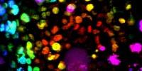 Primary Pancreatic Organoid Tumor Models for High-Throughput Phenotypic Drug Screening