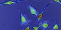 Scientists Create Technology That Measures Tumors' Drug Resistance up to 10 Times Faster