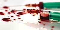 The Latest Guidelines for Preventing Exposure to Bloodborne Pathogens