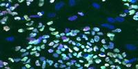 UCLA Research May Explain Some Causes of Infertility and Miscarriage