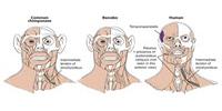 'Uniquely Human' Muscles Have Been Discovered in Apes