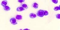 A New Achilles' Heel of Blood Cancer