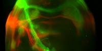 No More Sweet Tooth? Scientists Switch off Pleasure from Food in Brains of Mice