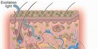 Simplifying Skin Disease Diagnosis with Topical Nanotechnology