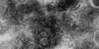 Surprising Discovery Could Improve Malaria Detection Worldwide
