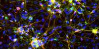 The Joy of Neurons: A Simplified 'Cookbook' for Engineering Brain Cells to Study Disease