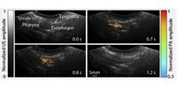 Beer. Soup. Barley's Next Great Use? A Medical Imaging Drink