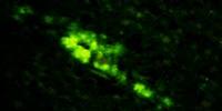 First Artificial Human Prion Created