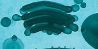 Isolating and Analyzing Extracellular Vesicles