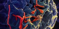 Proteins Found in Semen Increase the Spread of Ebola Virus Infection