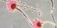 Chemists Characterize the Fatal Fungus Among Us