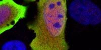 Gene Discovery Unlocks Mysteries to Our Immunity