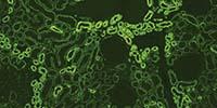How Quenching Tissue Autofluorescence Works