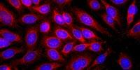 New Findings Suggest Allergic Responses May Protect Against Skin Cancer