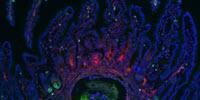 New Form of Wound Healing Revealed by Parasitic Gut Worms