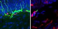 Non-Opioid Drug Relieves Pain in Mice, Targets Immune Cells