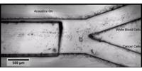 Sound Waves Could Provide 'Liquid Biopsies'
