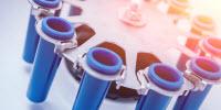 Centrifuge Buyer's Guide