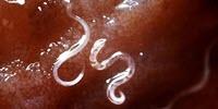 Changes in Gut Microbiome in Only One Subset of Helminth-Infected Patients