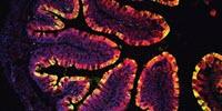 Chemicals Found in Vegetables Prevent Colon Cancer in Mice