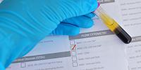 Fluorescence-Activated Cell Sorting for Cell-Based Therapies