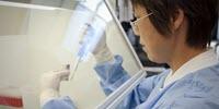HIV/AIDS Research Yields Dividends Across Medical Fields