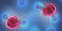 Sensor Could Help Doctors Select Effective Cancer Therapy