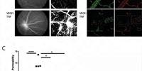 A Potential New Way to Treat Some of the Most Common Blinding Diseases