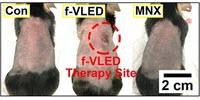 A Wearable Device for Regrowing Hair
