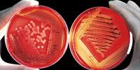 Microbial Identification by MALDI-TOF: Moving from Colonies to Blood Cultures and Biofilms