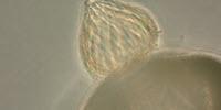 Expanding Fungal Diversity, One Cell at a Time