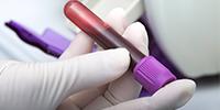 New Blood Test Can Rule Out Heart Attacks Earlier at Point of Care