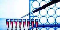 Speed and Sensitivity Give qPCR the Leg Up in Certain Clinical Cases