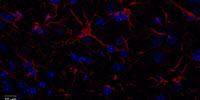 Sugar: A 'Sweet' Tool to Understand Brain Injuries