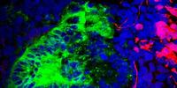 Brain, Muscle Cells Found Lurking in Kidney Organoids Grown in Lab